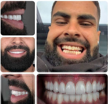 Slider image (4) Denart Turkey Dental Centre